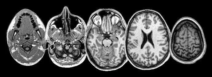 What Is An MRI and Why It’s Done