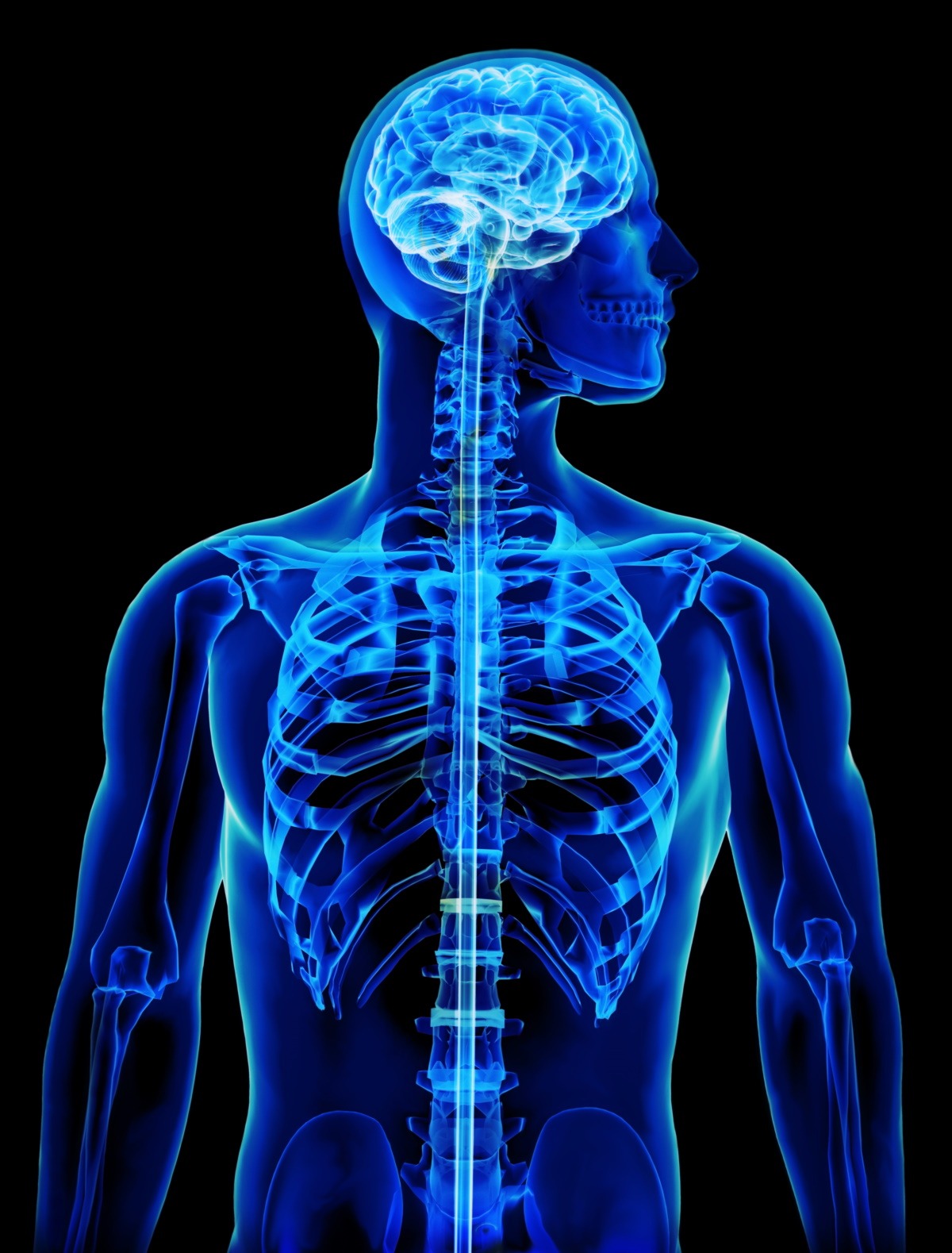 X-Ray, MRI, or CT Scan
