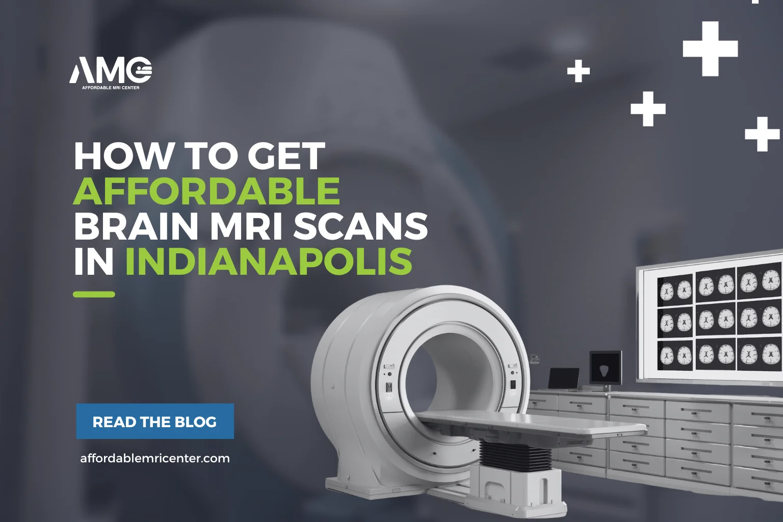 How To Get Affordable Brain MRI Scans in Indianapolis