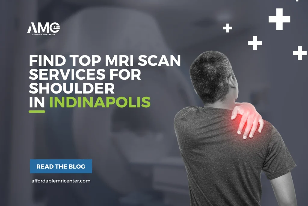 Find Top MRI Scan Services For Shoulders in Indianapolis