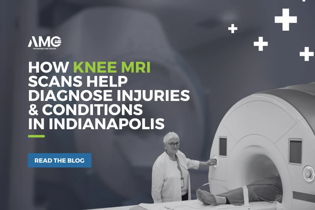 How Knee MRI Scans Help Diagnose Injuries & Conditions in Indianapolis