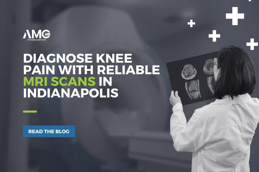 Diagnose Knee Pain with Reliable MRI Scans in Indianapolis