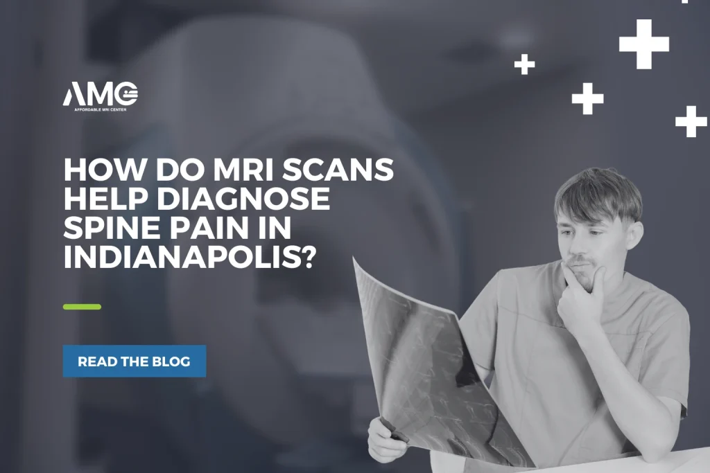 how do mri scans help diagnose spine pain in indianapolis