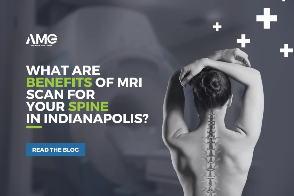 what-are-benefits-of-mri-scan-for-your-spine-in-indianapolis