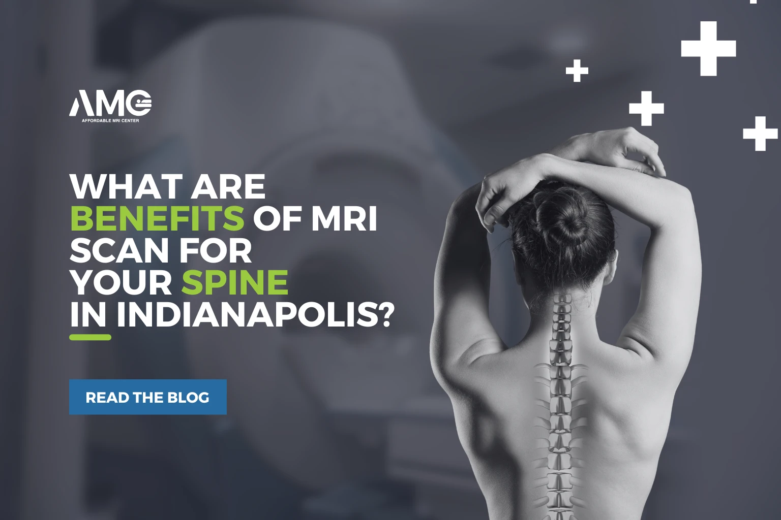 what-are-benefits-of-mri-scan-for-your-spine-in-indianapolis