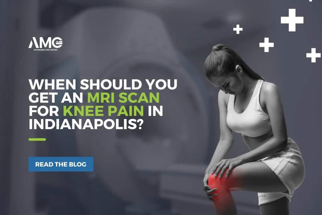 When Should You Get an MRI Scan for Knee Pain in Indianapolis