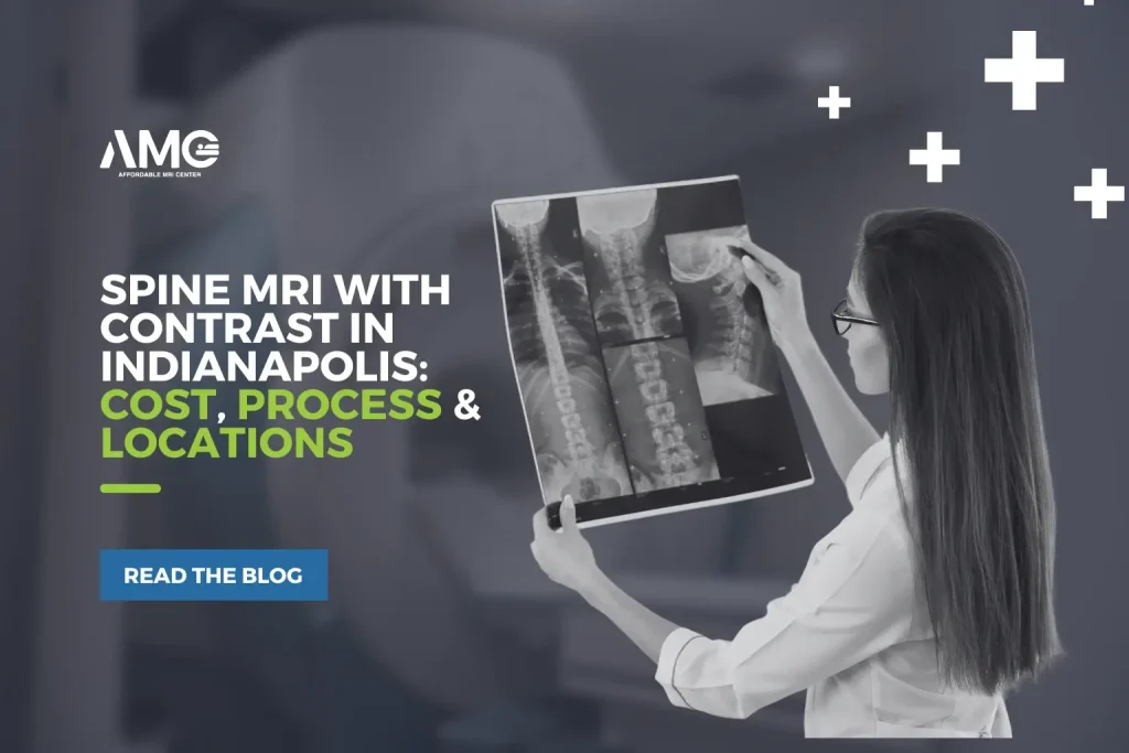 spine-mri-with-contrast-in-indianapolis-cost-process-&-locations