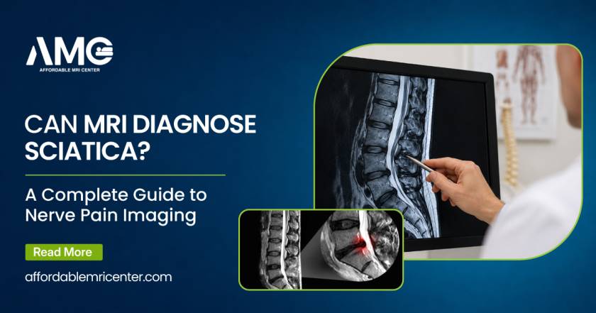 Can-MRI-Diagnose-Sciatica