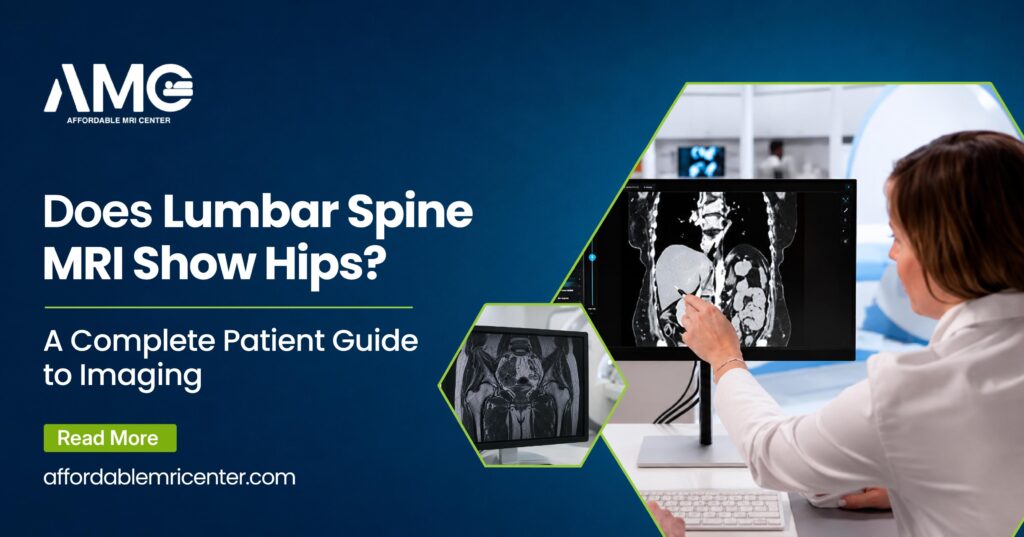 Lumbar Spine MRI Show Hips