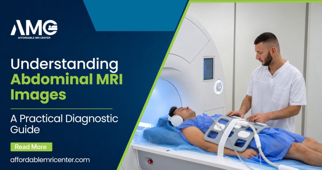 Abdominal MRI Images