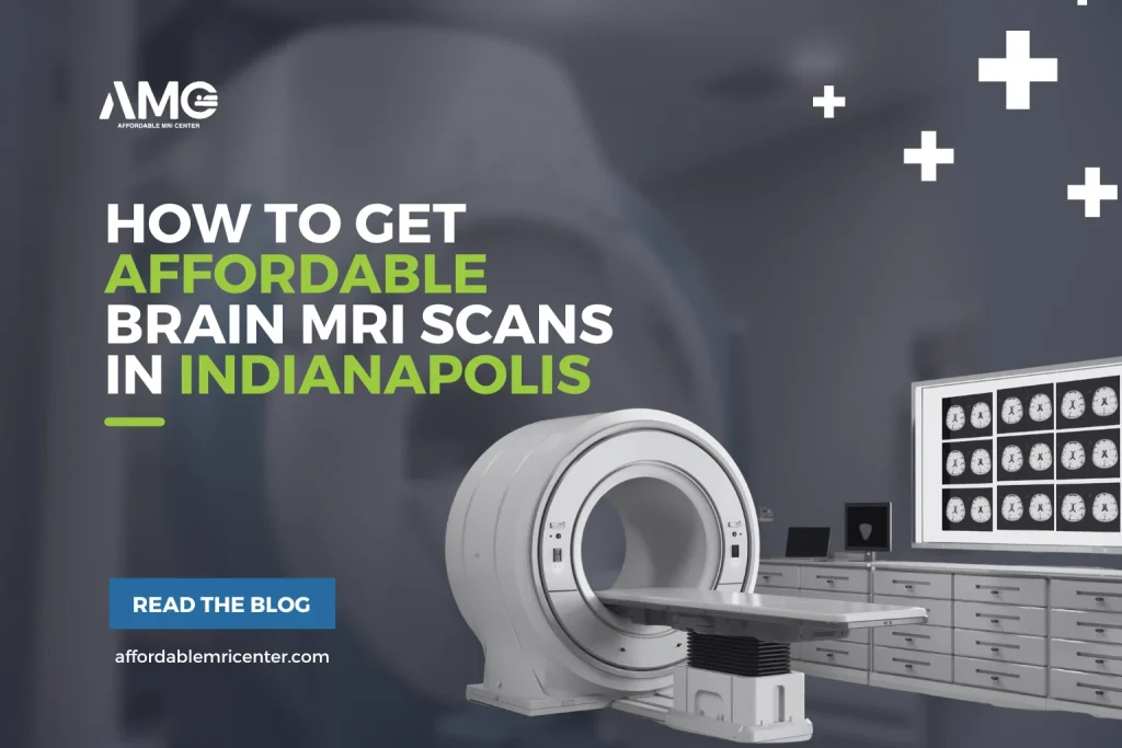 How To Get Affordable Brain MRI Scans in Indianapolis