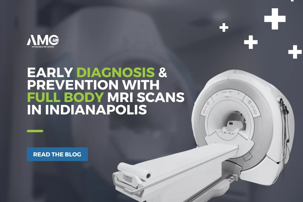 Early diagnosis and prevention with full-body MRI scans in Indianapolis
